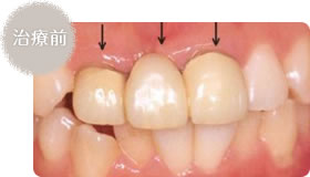 治療前