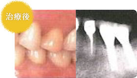 治療後