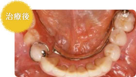 治療後