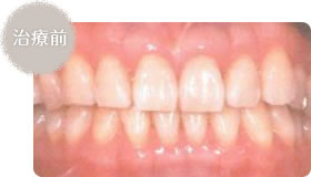 治療前