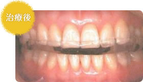 治療後